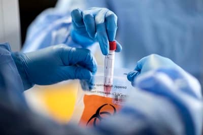Salud confirma 1.523 casos positivos y 35 fallecidos