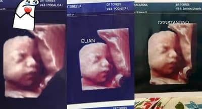 Clínica en Formosa entregaba misma ecografía a varias madres, denuncian
