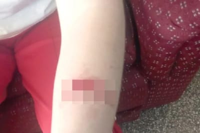 Alumna fue apuñalada por otra estudiante en colegio de Asunción