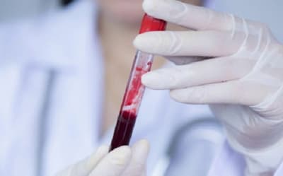 Día del Cáncer en Sangre: síntomas que no debés ignorar