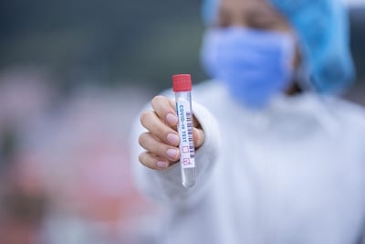 Salud reporta 16 fallecidos y 411 positivos