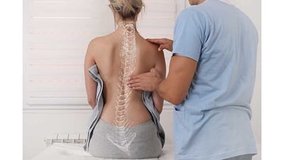 Escoliosis afecta predominantemente a mujeres adolescentes