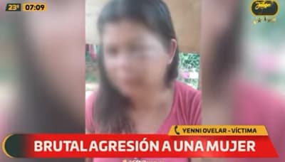 Mujer denuncia ataque por parte de su hermana y pareja en Areguá