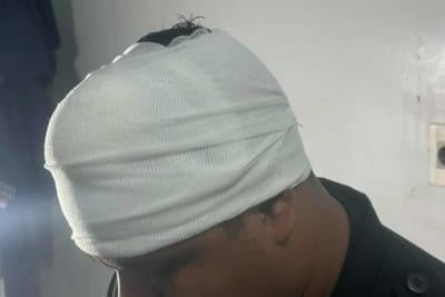 Policía recibe machetazo durante intervención en Luque