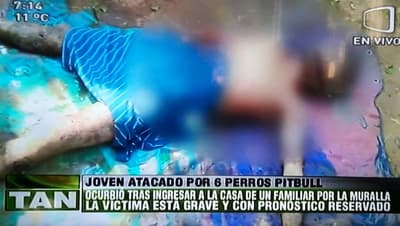Hombre atacado por perros pitbull está grave