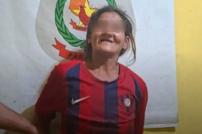 Mujer habría apuñalado a su pareja y ambos terminaron detenidos en Asunción