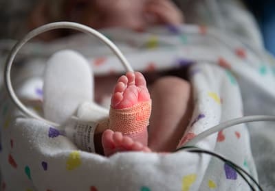 Dengue causa muerte de bebé prematura