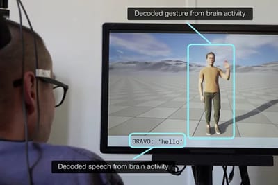 Implante cerebral permite hablar y gesticular con un avatar