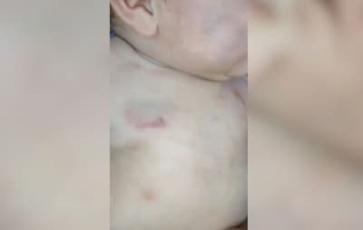 Bebé internado tras presunta agresión en Minga Guazú