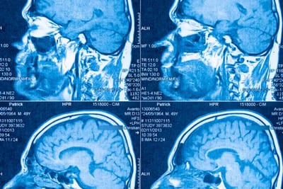 El cerebro humano está formado por dos órganos distintos, revela estudio
