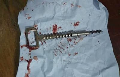 Asesinan a joven con un sacacorchos
