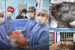 Extirpan tumor de 14 kilos en hospital del IPS